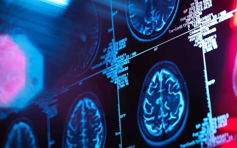 MRI brain scan cross-section showing brain structure — the science behind our health technology
